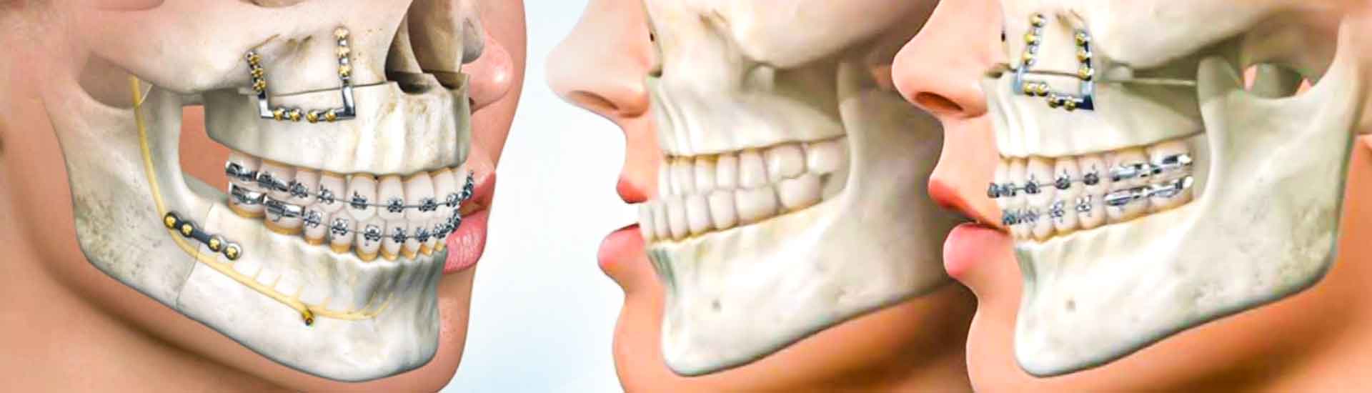 Improving Quality Of Life Through Maxillofacial Surgery