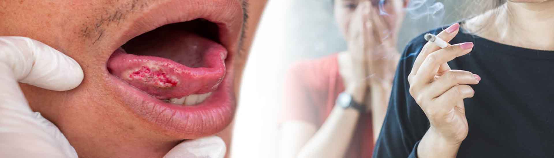 Bad Habit Today Can Make Risk Tomorrow The Reality Of Oral Cancer
