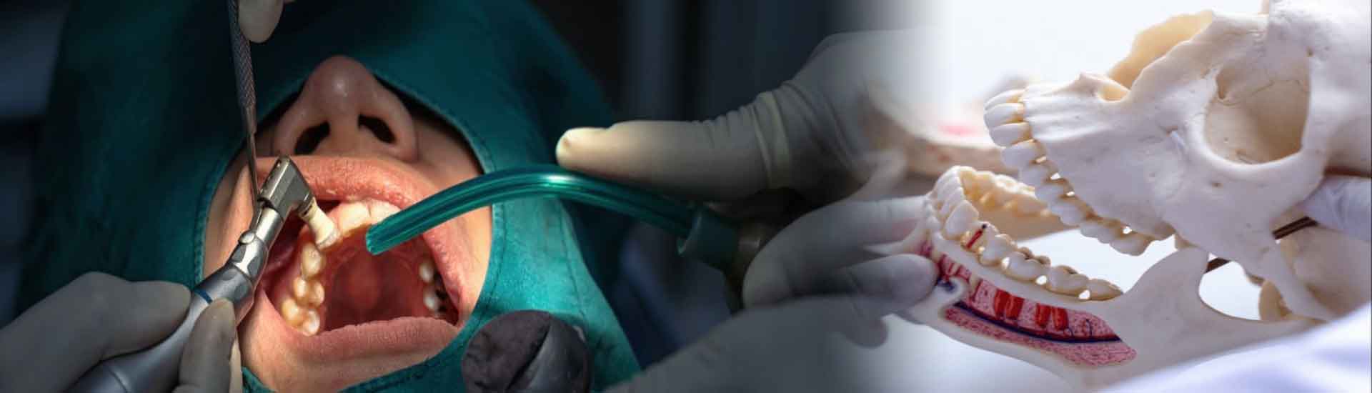 How a Maxillofacial Surgeon Can Transform Your Oral Health?